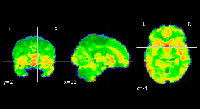 ../../_images/88936e44502eaa358acd1cdef4421074a18894e1bca8a05351c3429a323560fa.png