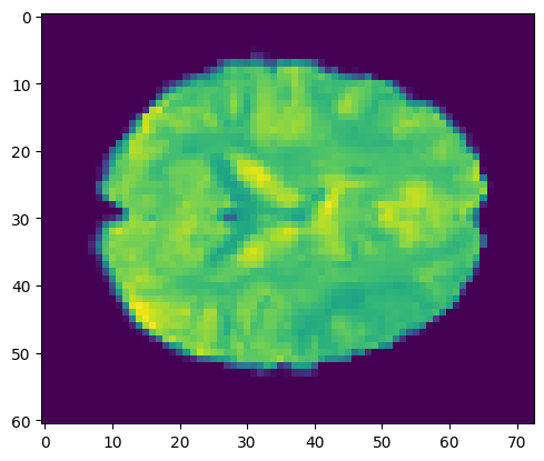 ../../_images/db2921984f3fae4b4d4579a1a58e8d4cafdf1da8dbd26d325a1c1a4a9c76c1b4.png